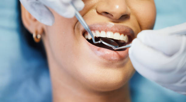Best Walk-In Emergency Dental Services in Cascade, ID